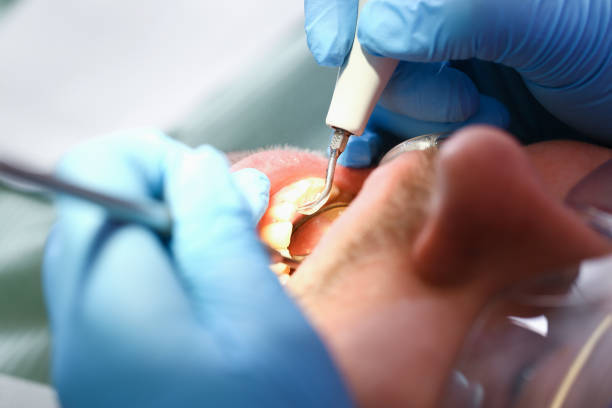 Best Pediatric Emergency Dentist in Iowa Park, TX