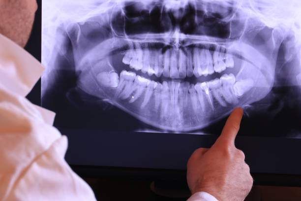 Best Emergency Dental Care for Broken or Chipped Teeth in Iowa Park, TX