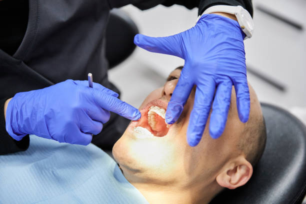 Best Emergency Treatment for Dental Infections or Abscesses in Iowa Park, TX